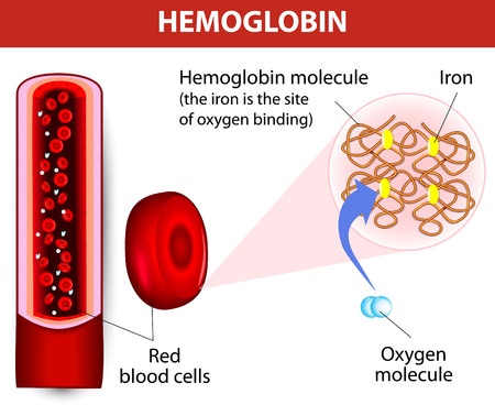 iron anemia hemoglobin deficiency treatment overview options