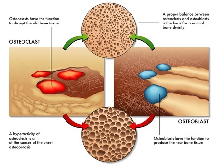 osteoporosis osteoclasts and osteoblasts